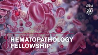 Hematopathology Fellowship at Loyola University Medical Center
