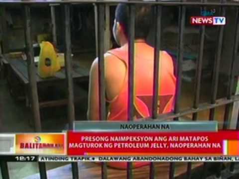 Na ginawa pagwawasto sa suso Dibdib pagpapalaki lumang pamamaraan