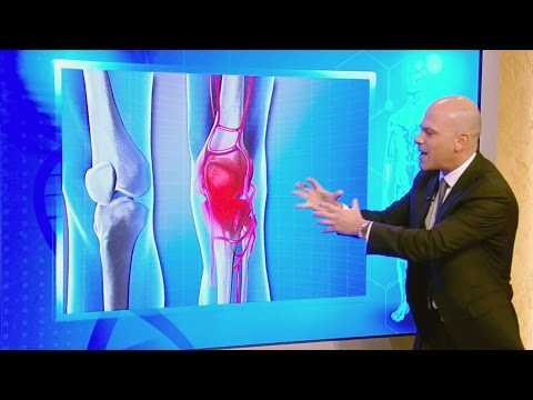 Fizioterapie dureri de genunchi