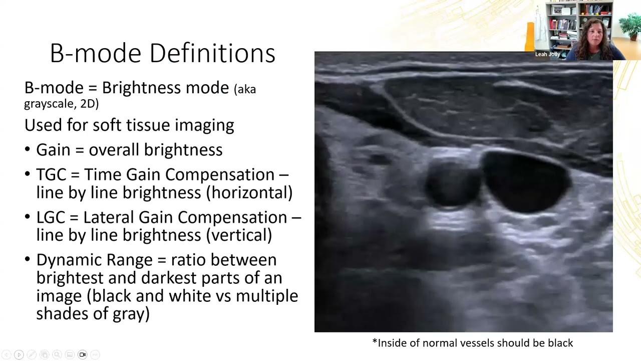 Vascular Imaging Webinar Series: Physics, Knobology, And Hemodynamics