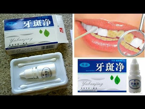 Yabanjin teeth whitening review