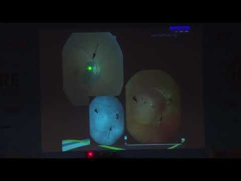 AIOC2019 - IC141 - Retinal Imaging: Reading between the lines