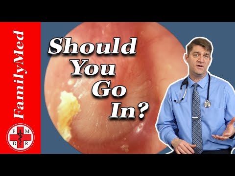 EAR INFECTION or Otis Media: When to Call the Doctor for that Earache (2019)