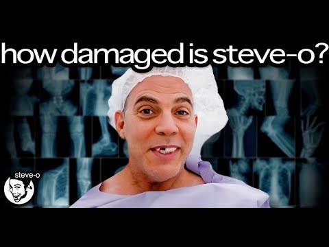 How My Body Is Holding Up | Steve-O
