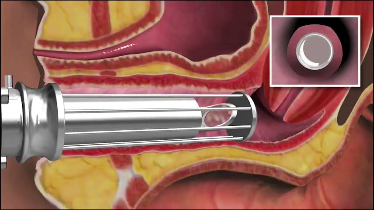 Danielle Carvalho-10