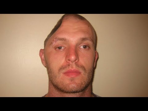 r/Nuclearrevenge I Broke a Man's Skull