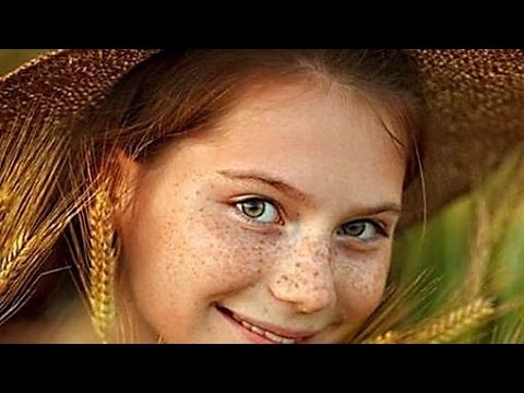 Избавиться наследственных веснушек Фототерапия в лечении пигментации лица