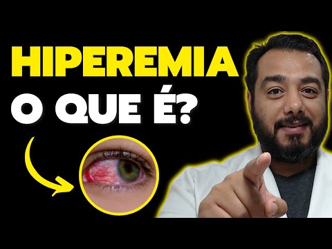 Hyperemia: what is it, how does it occur? | Human Pathology | Prof. Dr. Victor Proença - IBAP Cou...