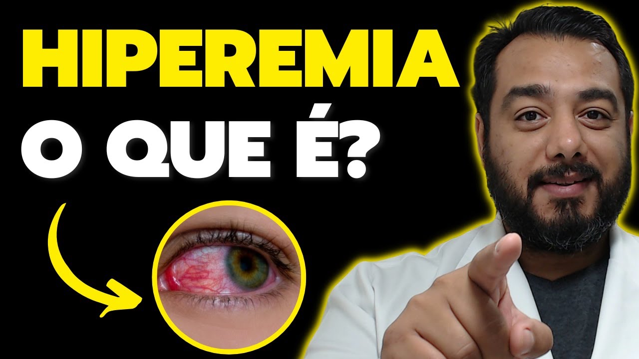 Hiperemia: o que é, como ocorre? | Patologia Humana | Prof. Dr. Victor Proença - IBAP Cursos