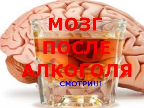 Мозг человека после употребления алкоголя.Смотри!!!