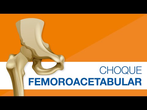 ¿Qué es el choque femoroacetabular?