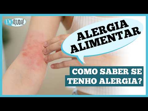 Você tem ALERGIA a algum ALIMENTO? Como identificar? #alergia #intolerancialactose