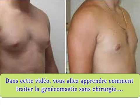 comment guerir gynecomastie