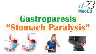 Gastroparesis (Stomach Paralysis) | Causes and Risk Factors, Signs & Symptoms, Diagnosis,  Treatment