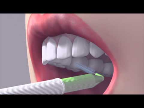 How to use an interdental brush