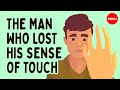 The man who lost his sense of touch - Antonio Cataldo