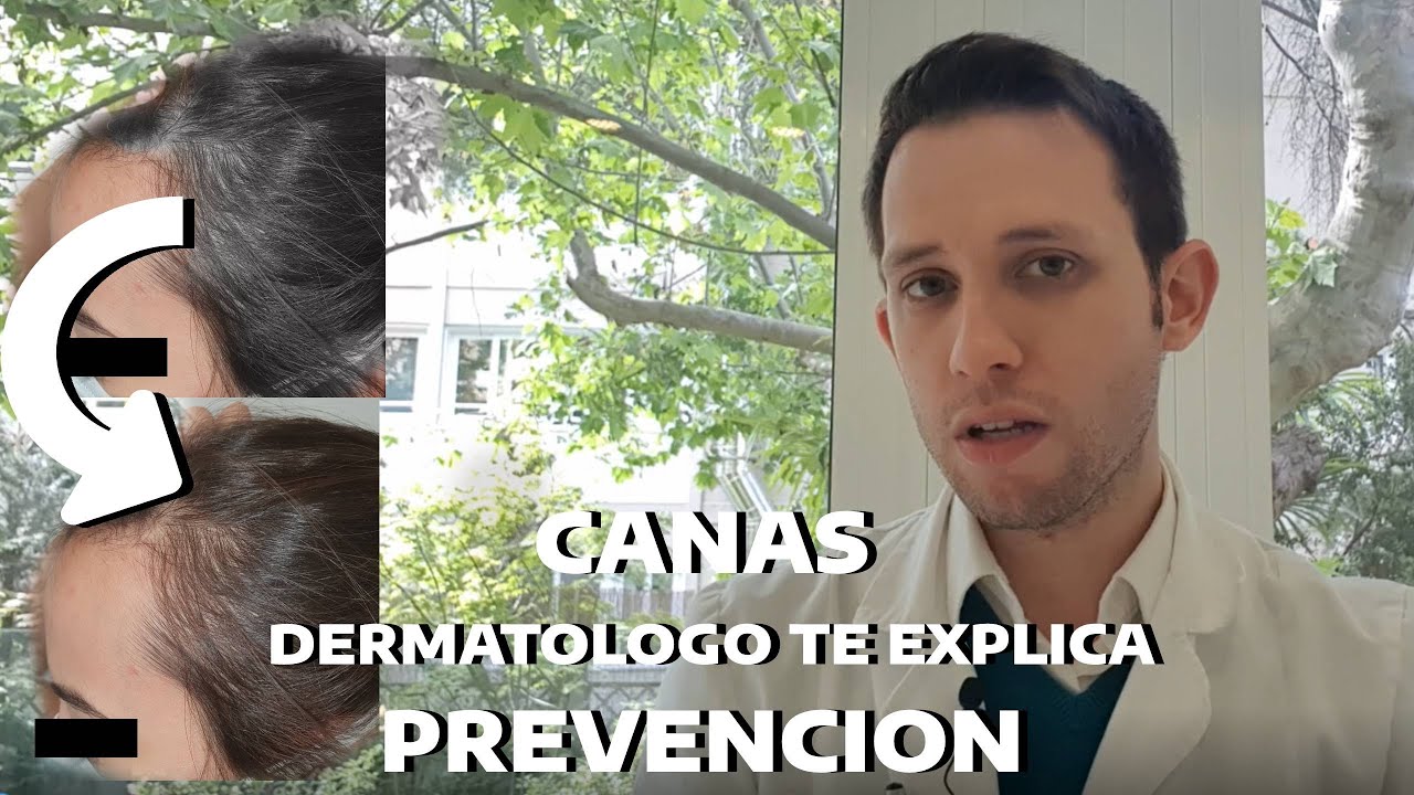 Watch CANAS y su PREVENCIÓN: DERMATÓLOGO te lo explica. Now CANAS y su PREVENCIÓN: DERMATÓLOGO te lo explica.