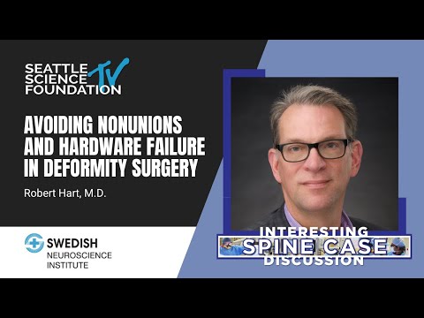 Avoiding Nonunions and Hardware Failure in Deformity Surgery - Robert Hart, MD