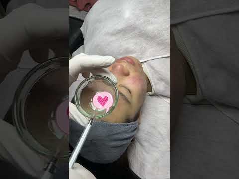 Acne Treatment in Poipet