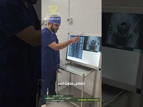 نجاح علاج ورم غضروفي بالحوض