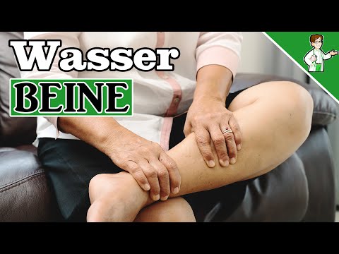 Wassereinlagerungen in den Beinen - Diese 8 Tipps helfen 🧊✅