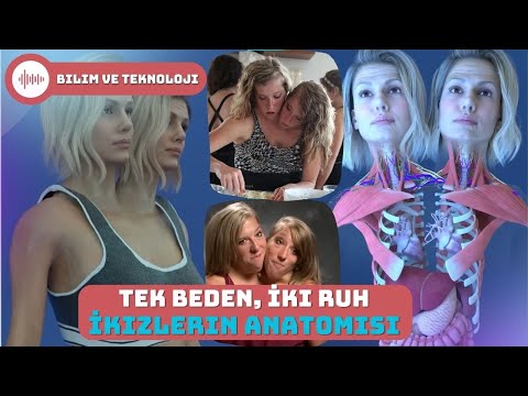 İki Ruh Tek Beden: Abby ve Brittany Hensel İkizlerinin Eşsiz Anatomisi #FloraFauna