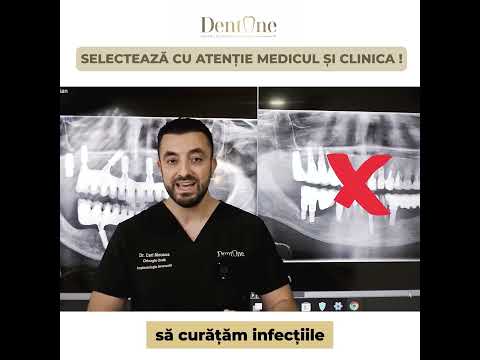 Are importanta unde mergem sa ne tratam dintii sau sa inseram implanturi?