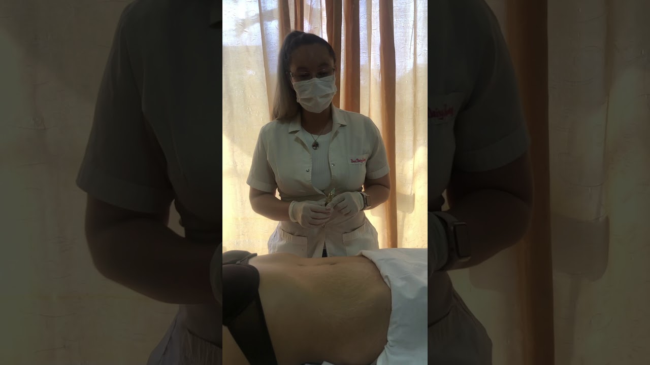 Mesoterapia Tensora y Reafirmante