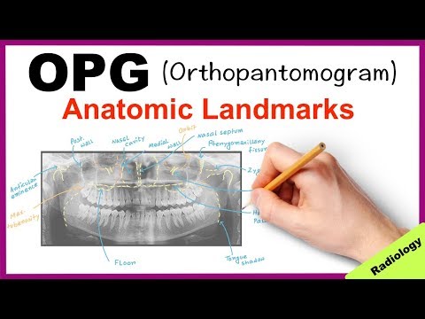 Orthopantomogram (OPG) Anatomical Landmarks - Radiology