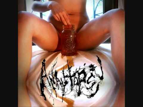 Anautopsy - You Still Can't Spell Slaughter Without Laughter