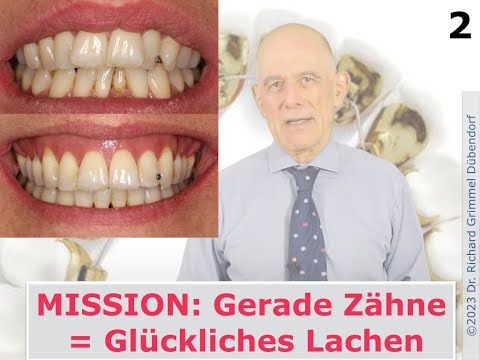 Mission: Gerade Zähne - Glückliches Lachen Nr 2 Lingualtechnik von Anfang bis Ende statt Aligner