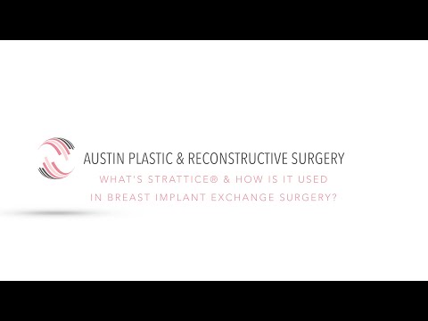 What's Strattice® & How is it Used in Breast Implant Exchange Surgery?
