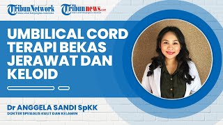 Umbilical Cord, Terapi Kekinian untuk Menghilangkan Bekas Jerawat dan Keloid