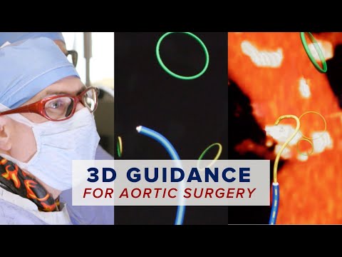 Watch video titled The Penn Medicine Aorta Center on YouTube