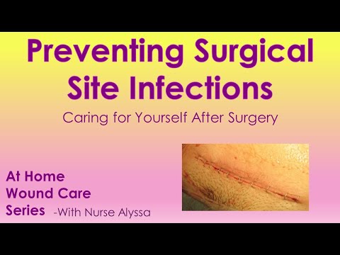 Surgical Site Infections : Prevention