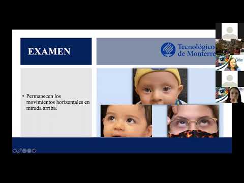 College Oftalmopediatría