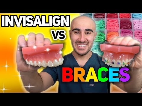 Braces vs Invisalign: Cost, Tooth Pain, Speed, etc - The ULTIMATE Review 🔥