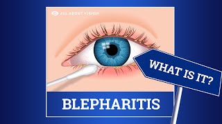 Blepharitis (red swollen eyelids): Causes, Symptoms, Treatments