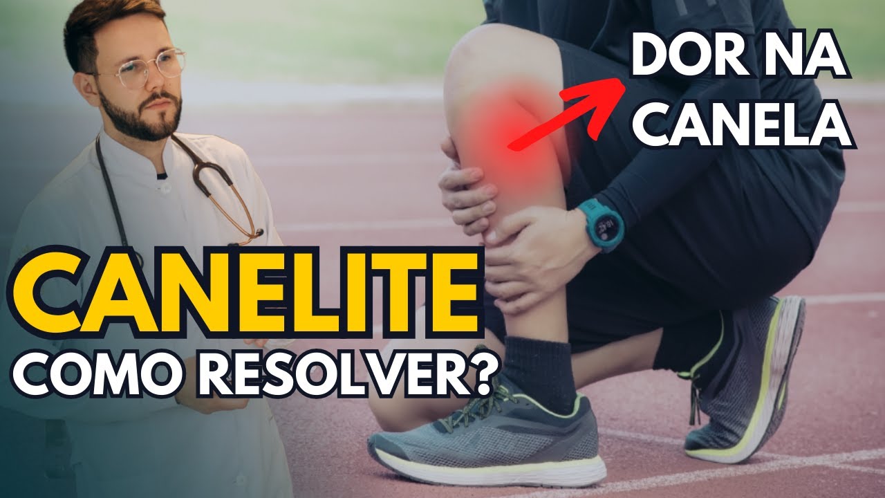 COMO RESOLVER A CANELITE? (DOR NA CANELA)