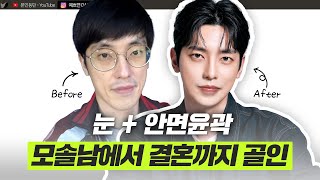 소개팅 성공→결혼! 맥미남 홍민기의 리얼 성형 후기ㅣ디에이성형외과ㅣ디에이성형외과의원