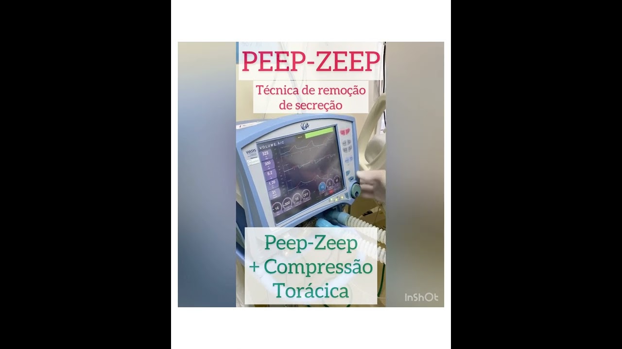 PEEP-ZEEP