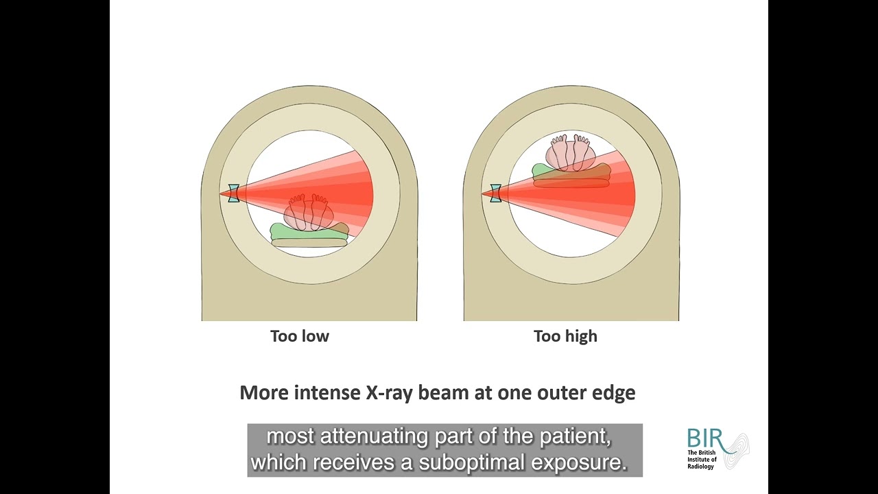 BIR Video Course: CT Essentials 2024 - Sample content