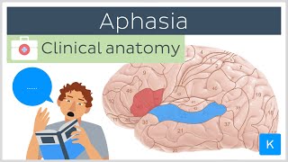 Aphasia: Wernicke&#39;s vs Broca&#39;s - Clinical Anatomy | Kenhub
