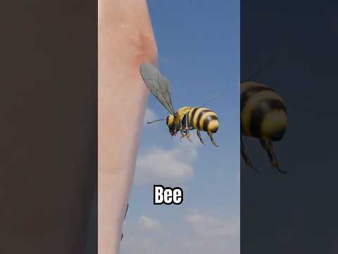 He got stung by a bee 😱
