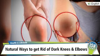 Natural Ways to get Rid of Dark Knees & Elbows