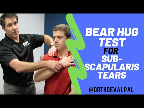 NEER Shoulder Impingement Sign