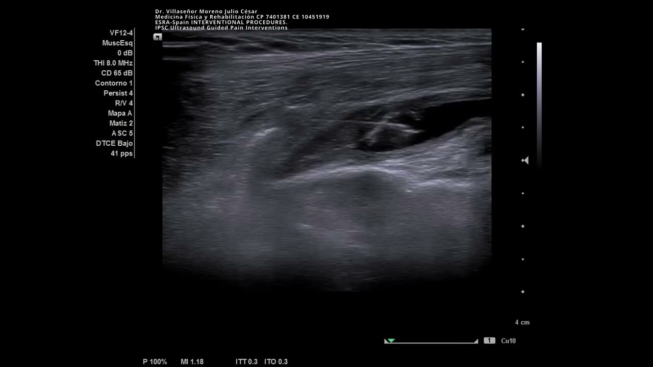 Julio César Villaseñor Moreno-18