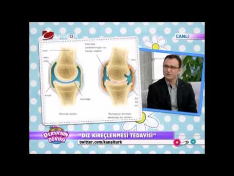 Entzündete Daumen am Gelenke Welche Vitamine trinken bei Rückenschmerzen