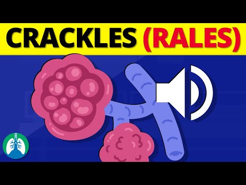Crackles (Rales) | Medical Definition and Explanation