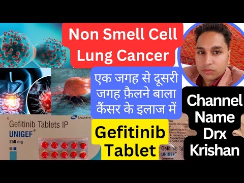 250mg Gefitinib Tablets